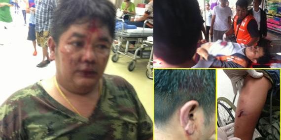 ทหารเดือด! ถูกวิน จยย.ใช้ไม้ฟาดหัว คว้า 9 มม.ยิงสวนสาหัส