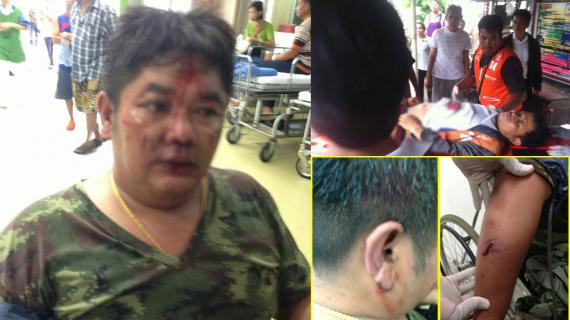 ทหารเดือด! ถูกวิน จยย.ใช้ไม้ฟาดหัว คว้า 9 มม.ยิงสวนสาหัส