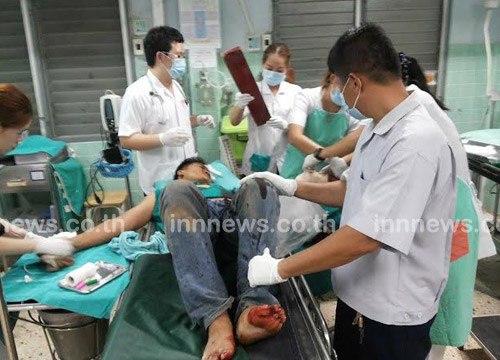 สยอง พ่อค้าก๋วยเตี๋ยวถูกฟันมือขาด เมียคว้าข้อมือส่งหมอต่อ