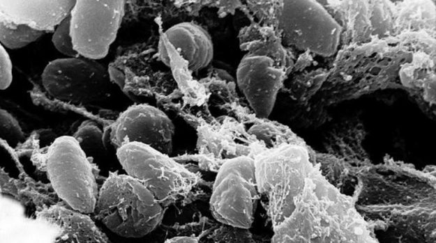 จีนปิดเมืองหลังพบคนตายเพราะ 'กาฬโรคปอด'