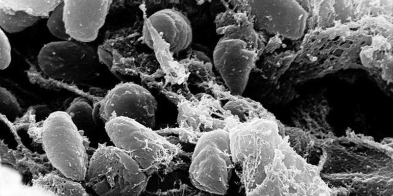 จีนปิดเมืองหลังพบคนตายเพราะ ‘กาฬโรคปอด’ จีนปิดเมืองหลังพบคนตายเพราะ 'กาฬโรคปอด'