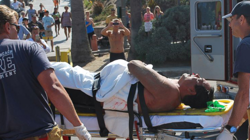 ฉลาม 7 ฟุต กัดชายมะกันเจ็บ ที่ชายหาดแคลิฟอร์เนีย