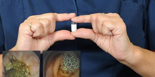 กล้องจิ๋วไซส์แคปซูล