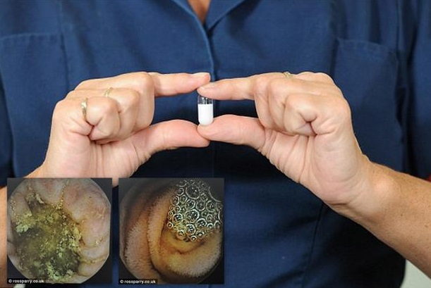 กล้องจิ๋วไซส์แคปซูล