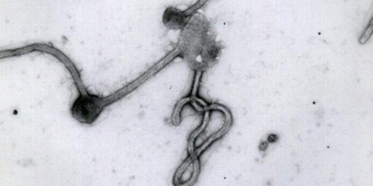 พม่าส่งเลือด ชายสงสัยติดเชื้ออีโบลา ไปตรวจที่อินเดียแล้ว พม่าส่งเลือด ชายสงสัยติดเชื้ออีโบลา ไปตรวจที่อินเดียแล้ว