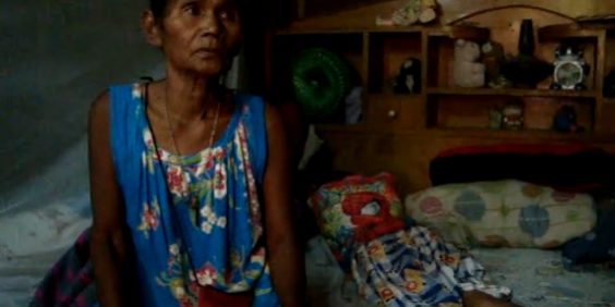 น้องแสตมป์ เก็บคอนแทคเลนส์จากกองขยะมาใส่เล่น ตาอักเสบ เสี่ยงตาบอด