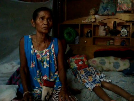 น้องแสตมป์ เก็บคอนแทคเลนส์จากกองขยะมาใส่เล่น ตาอักเสบ เสี่ยงตาบอด